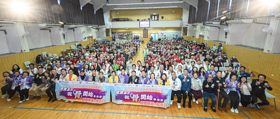 【骨質疏鬆】隱形殺手無病徵？ 高永文：收經後婦女屬高危 籲60歲以上男士亦應檢測